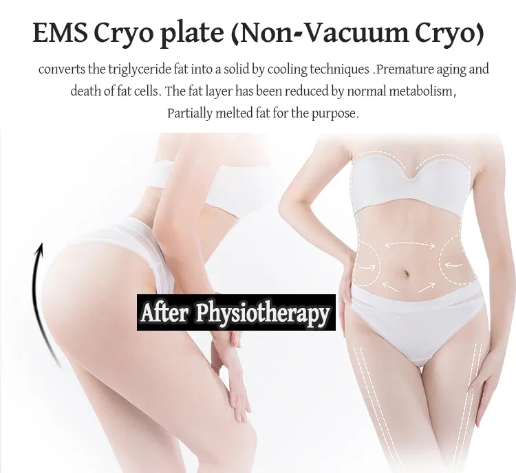 Appareil portable de cryolipolyse pour maigrir et éliminer la cellulite, plaques cryo avec EMS