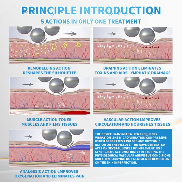 Réduction de la cellulite Contournement du corps Drainage lymphatique Roulis minceur 360° Massage à rouleau interne 6D