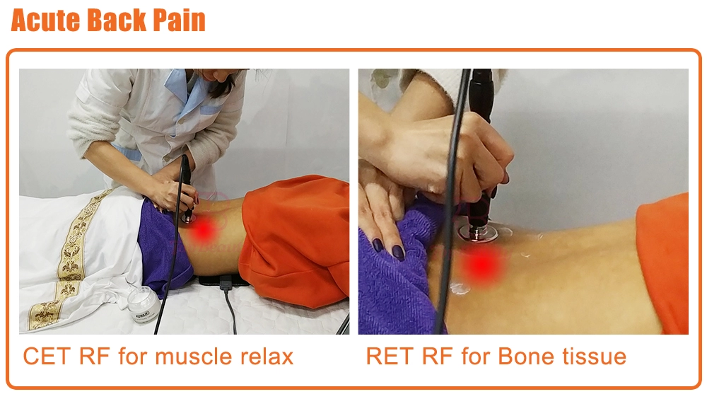 Thérapie Tecar Physio Machine RF Monopolaire Résistive et Capacitive Tecarterapia Professionnelle