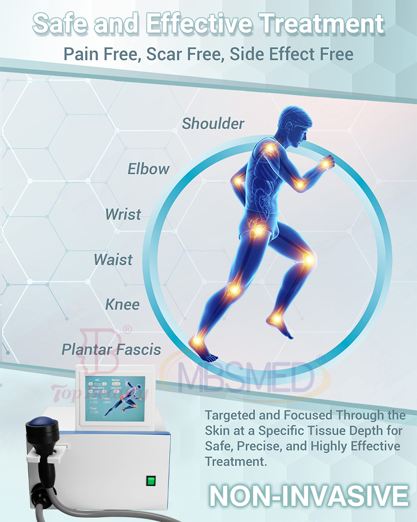Vente chaude système de choc eswt ed focus shockwave, machine de thérapie par choc ciblé, Shockwave Physique