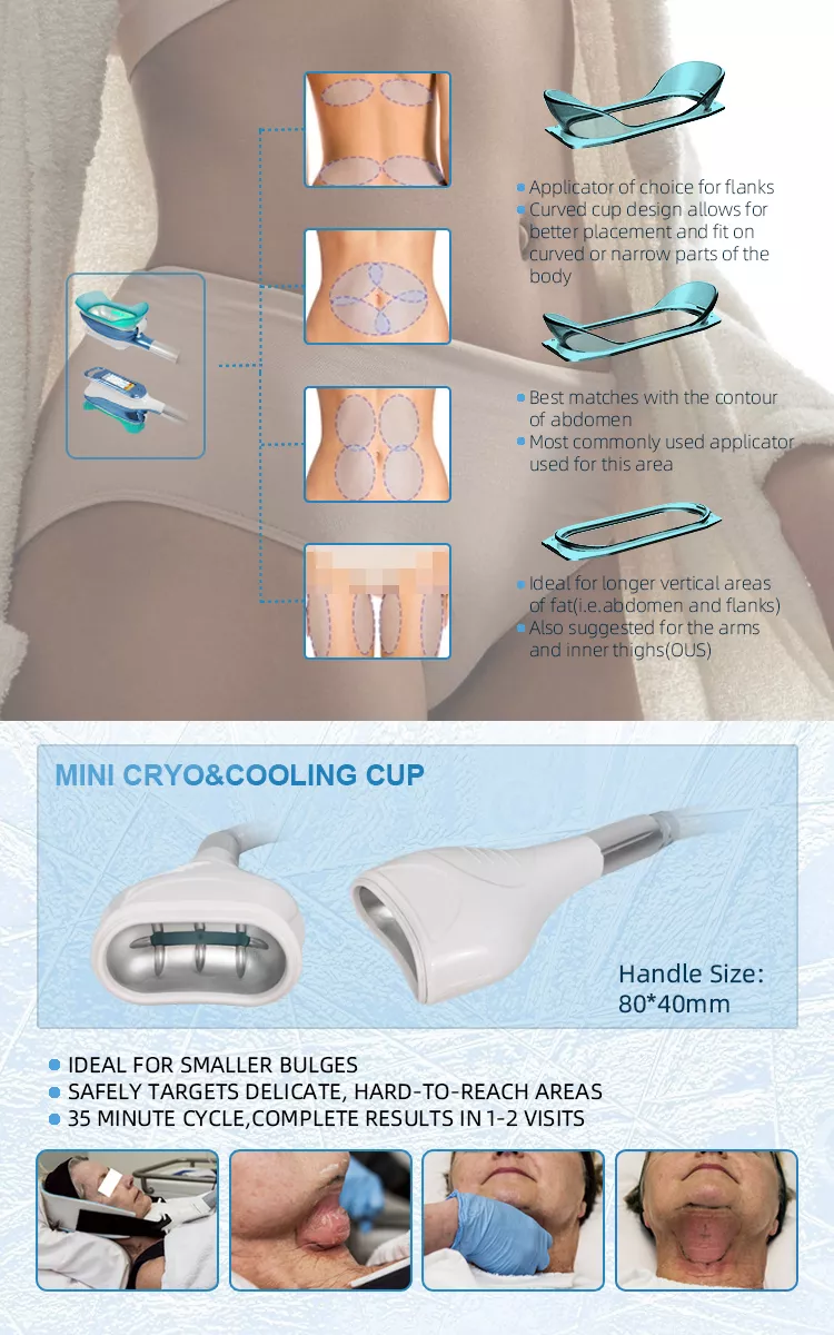 Vente en usine 2022 Machine d''amincissement par cryolipolyse 360 / Machine de refroidissement des graisses Cool Tech Réduction de la cellulite