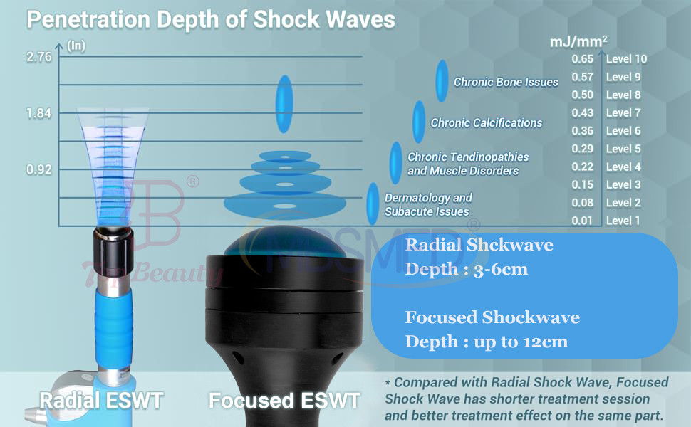 Vente chaude système de choc eswt ed focus shockwave, machine de thérapie par choc ciblé, Shockwave Physique