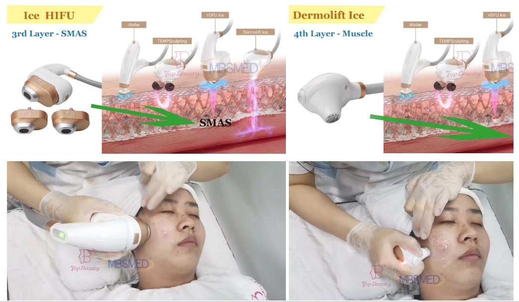 Machine HIFU 12D ICE pour le lifting facial, resserrement de la peau HIFU