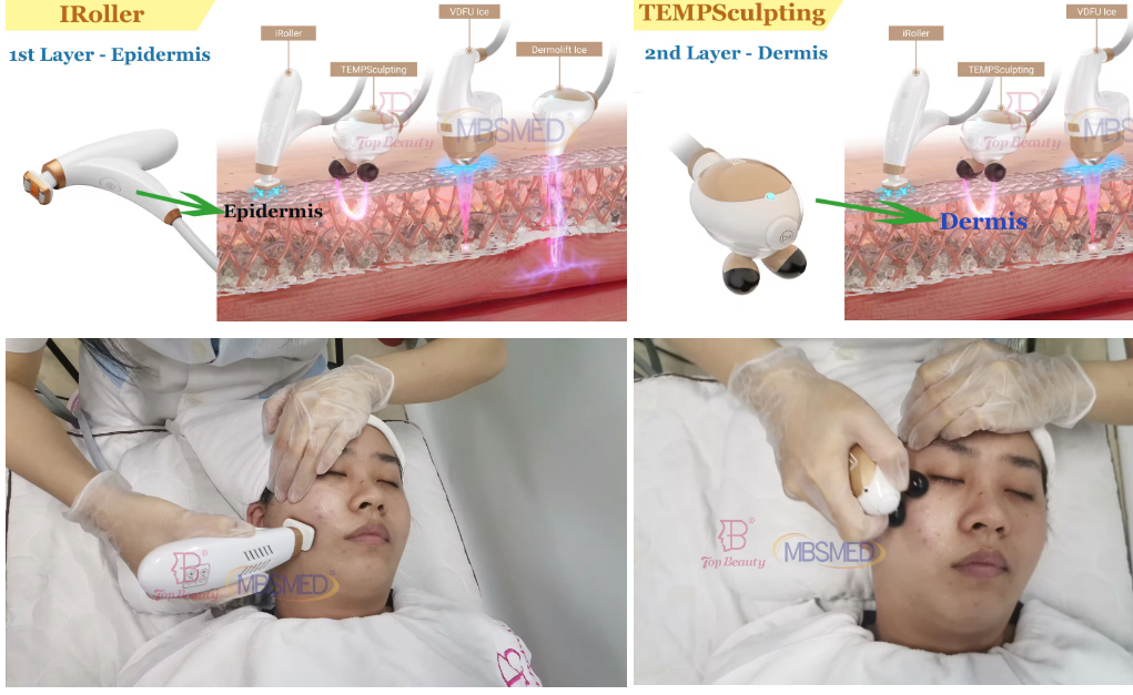Machine HIFU 12D ICE pour le lifting facial, resserrement de la peau HIFU