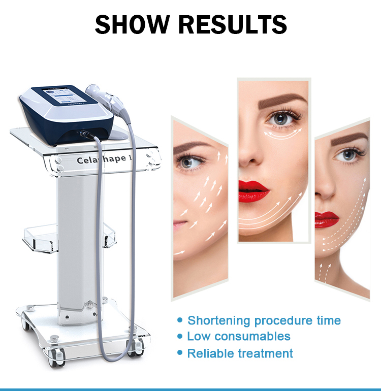 Équipement de beauté faciale à 5 têtes Radiofréquence RF Lifting et raffermissement du visage Élimination des rides Raffermissement de la peau Machine RF