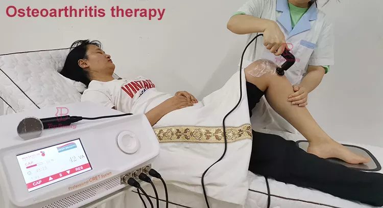 Soulagement de la douleur portable 448Khz thérapie tecar indiba rééducation physique machine de thérapie par ondes tecar
