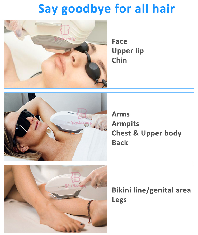 Nouvelle machine d''épilation à lumière pulsée intense de type IPL
