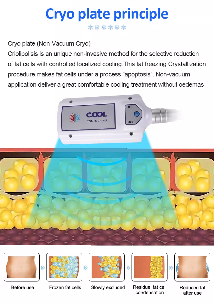 Appareil de cryolipolyse pour perte de graisse 2023 nouveau avec coussinets cryo pour maigrir Machine de cryolipolyse Coldtec
