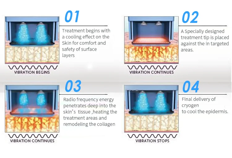 Appareil de raffermissement de la peau 2024, machine de lifting facial HIFU et de rajeunissement de la peau RF 2 en 1 Flx