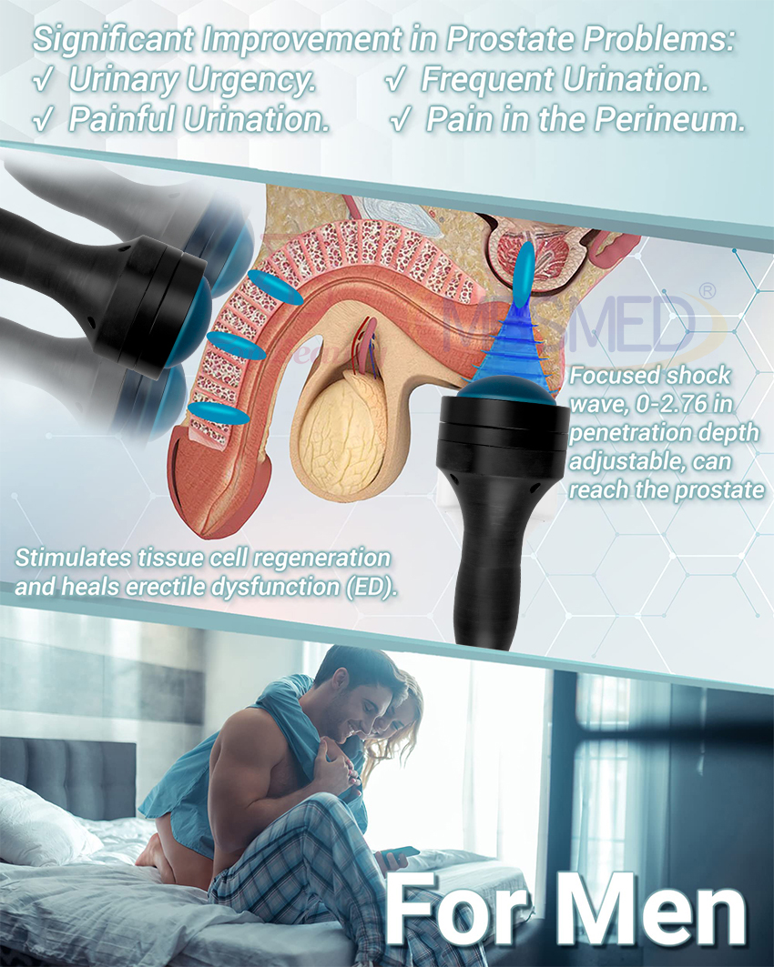 Vente chaude système de choc eswt ed focus shockwave, machine de thérapie par choc ciblé, Shockwave Physique