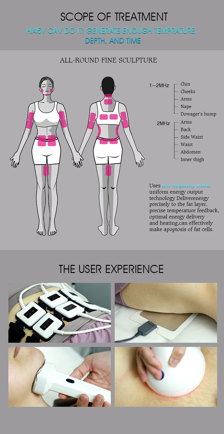 Appareil 3 en 1 pour salon utilisant Trusculpt Id Flex Rf pour le contournement du corps et la sculpture corporelle, traitement de la cellulite à 2mhz et réduction des graisses avec la machine Trufat