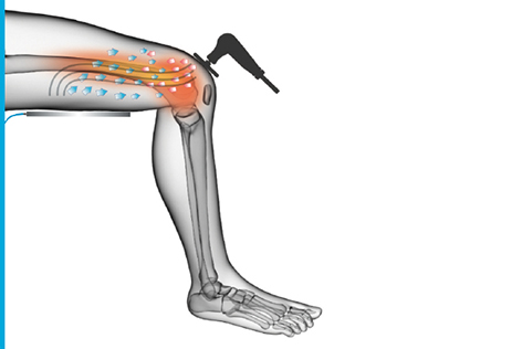 Appareil de physiothérapie Tecar 2.1, thérapie CET RET RF pour le soulagement de la douleur, appareil de physiothérapie intelligent 448khz Tecar