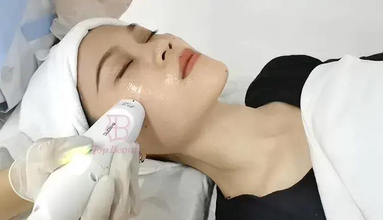 Machine de radiofréquence Mmfu Cyclone Rf Lifting facial indolore Machine Rf pour raffermir la peau et supprimer les rides