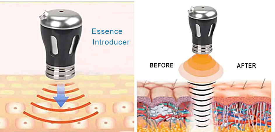 2 en 1 Appareil de beauté RF importé Dispositif de beauté EMS Machine anti-âge dispositif de lifting facial pour éliminer les rides Appareil de thérapie EMS à ultrasons