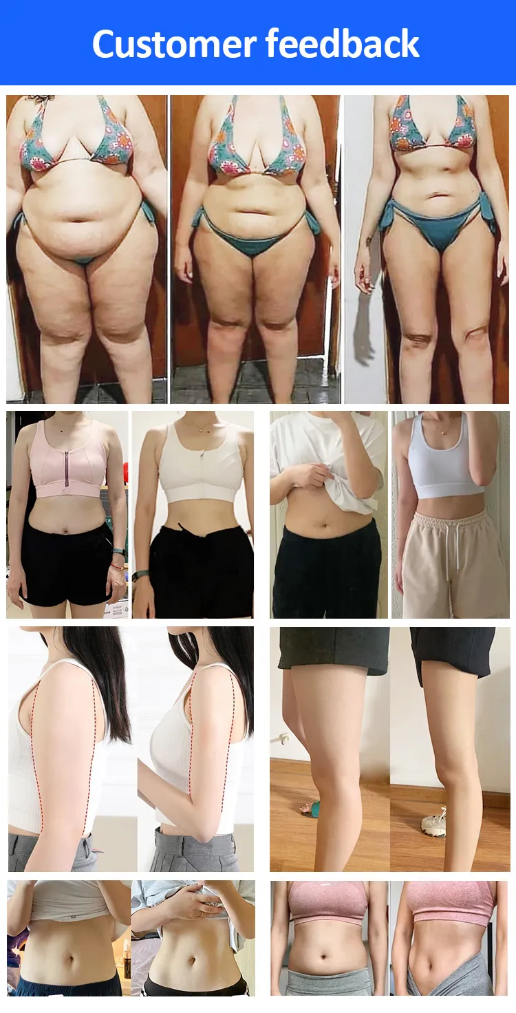 Appareil portable de cryolipolyse pour maigrir et éliminer la cellulite, plaques cryo avec EMS