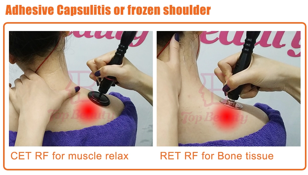 Thérapie Tecar Physio Machine RF Monopolaire Résistive et Capacitive Tecarterapia Professionnelle