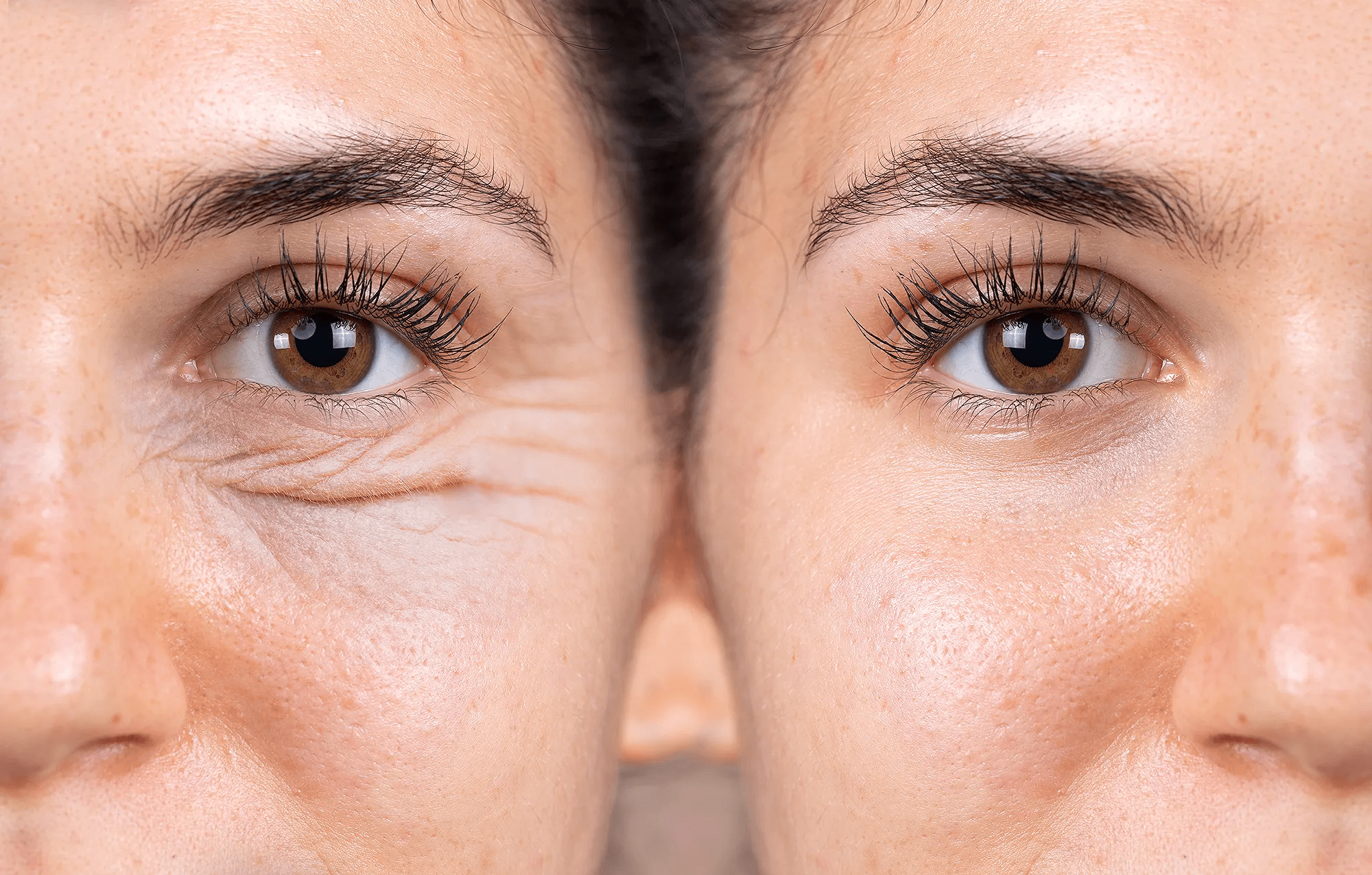 Fabricant professionnel Masque de thérapie à oxygène pour le visage en Corée 1:1 Dôme O2Toderm Oxgen Spray Jet Peel Machine faciale à oxygène