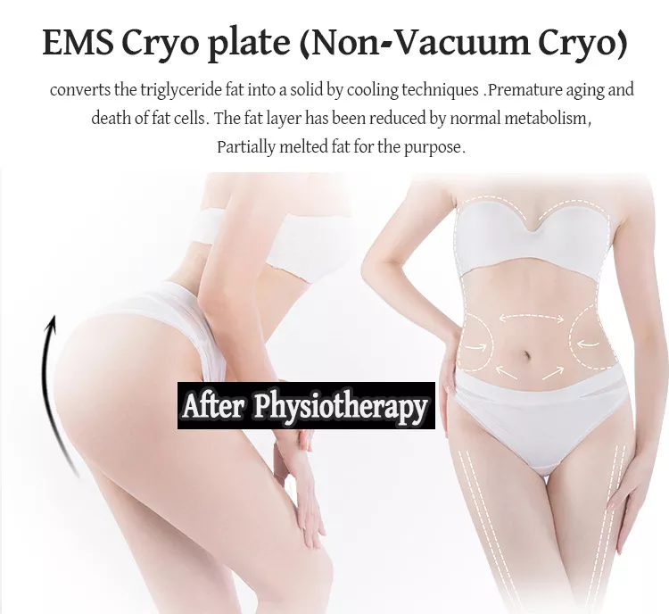 2023 Nouvelle machine EMS de congélation des graisses avec plaques de refroidissement Cryo pour l''amincissement du ventre Cryolipolyse sans douleur