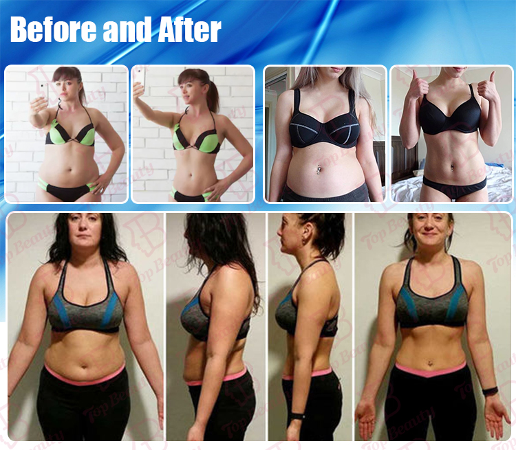 Machine de cavitation Lipo 80k Machine d''amaigrissement par cavitation Système de liposuccion Kim 8 Système d''amaigrissement -