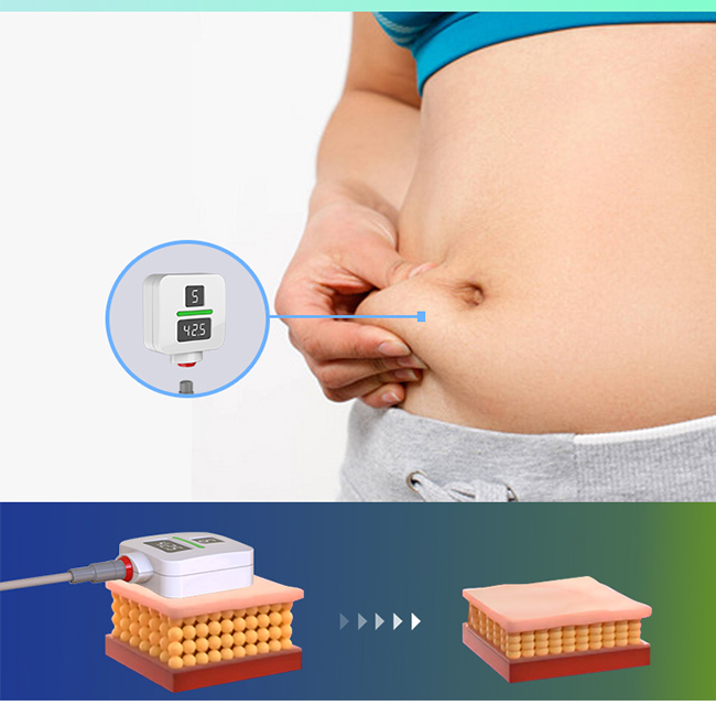Machine de Traitement Trushape ID Ems Stimulation Électrique des Muscles Sculpture Corporelle Emslim