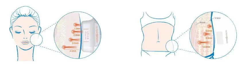Appareil de raffermissement de la peau 2024, machine de lifting facial HIFU et de rajeunissement de la peau RF 2 en 1 Flx