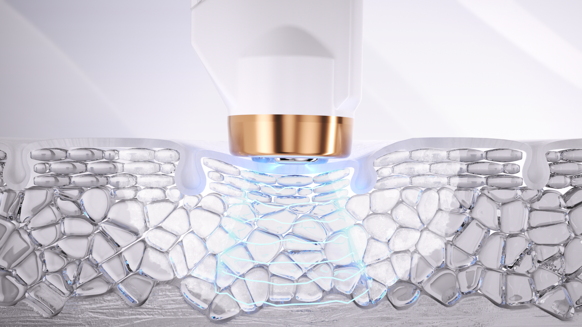 Étape 3 Infusion dans la peau