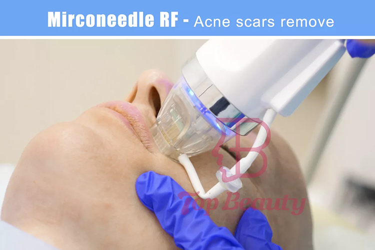 Appareil de microneedling fractionné RF à microneedles