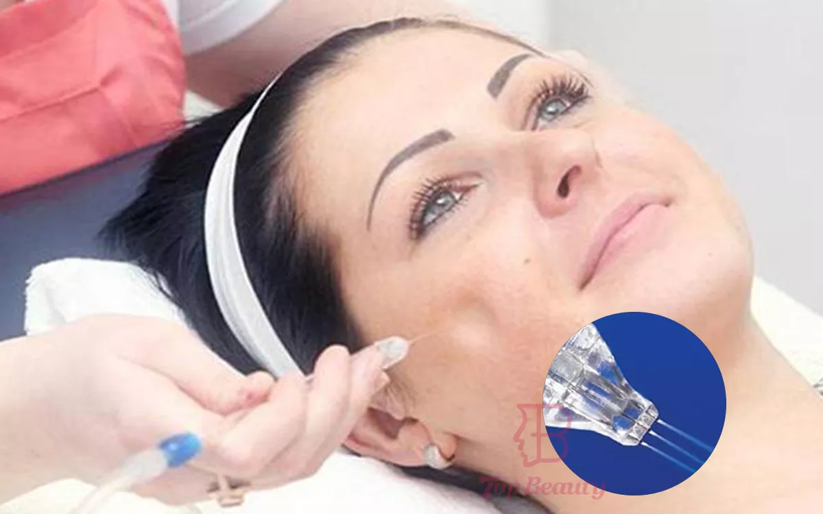 Résultat du traitement de Jet de peeling à l''''oxygène