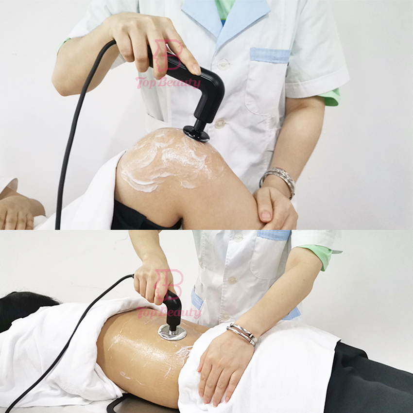 Machine Indiba Diathermie Tecarterapia Smart pour la combustion profonde des graisses Rf Tecar Physiothérapie