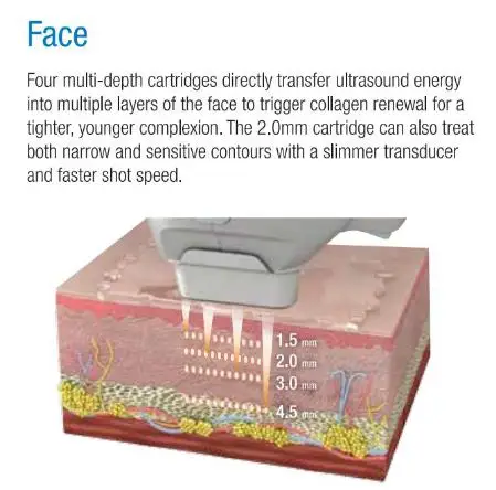 Appareil de raffermissement de la peau 2024, machine de lifting facial HIFU et de rajeunissement de la peau RF 2 en 1 Flx