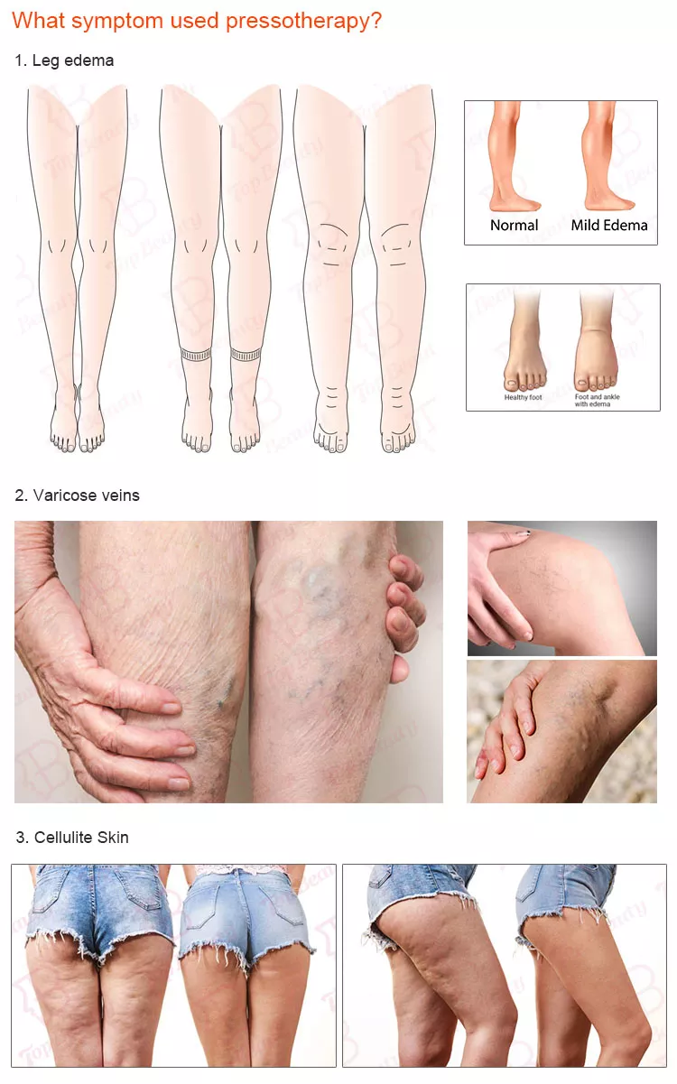 Bottes professionnelles de pressothérapie pour drainage lymphatique machine massage