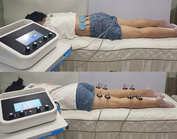 Stimulateur musculaire EMS pour l''amincissement du corps, machine de thérapie par électrostimulation à ondes russes et cupping mammaire sous vide