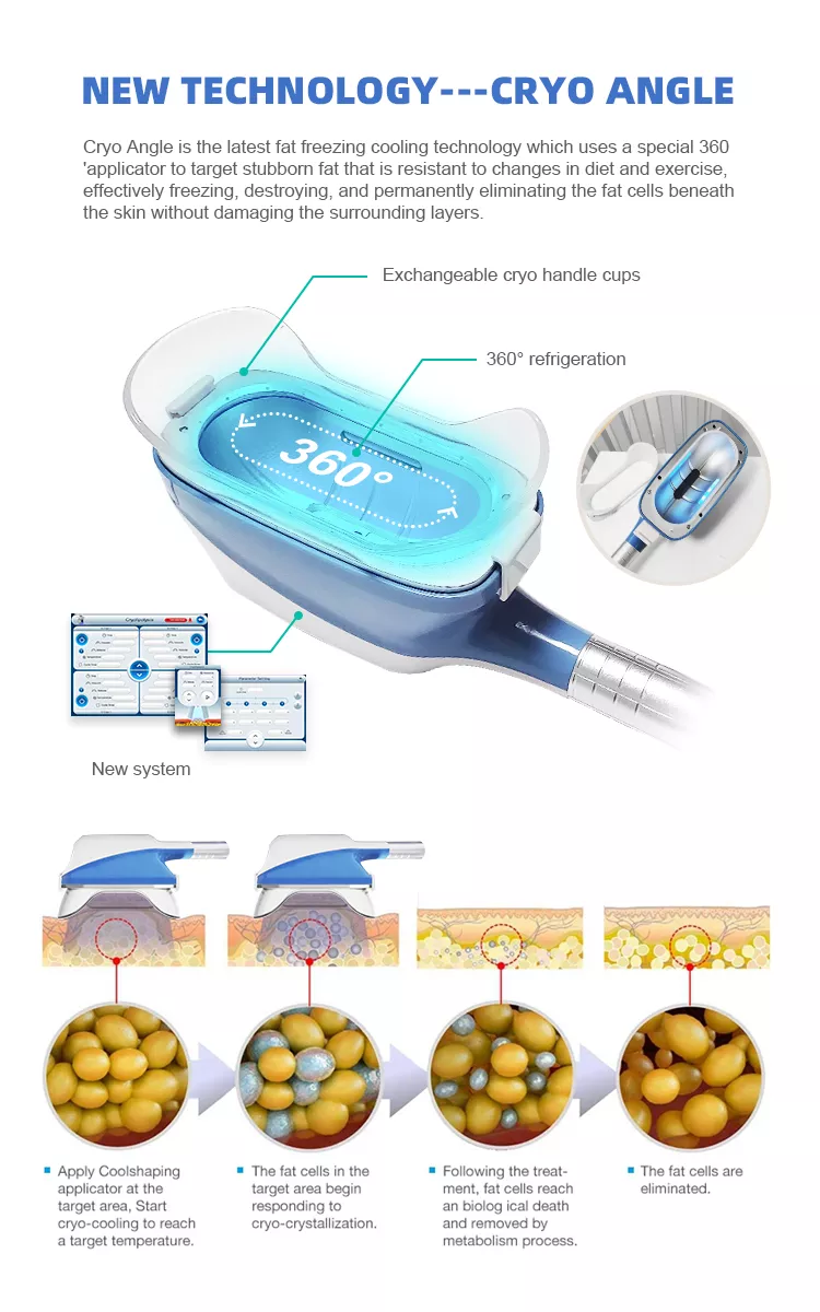 Machine de cryolipolyse 360 Cryo 2022 au meilleur prix pour perte de poids par cryolipolyse