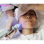 Appareil de soins du visage à jet d''eau oxygéné pour dermabrasion faciale anti-âge hydrodermabrasion