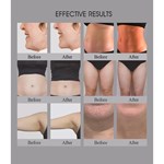 Appareil 3 en 1 pour salon utilisant Trusculpt Id Flex Rf pour le contournement du corps et la sculpture corporelle, traitement de la cellulite à 2mhz et réduction des graisses avec la machine Trufat