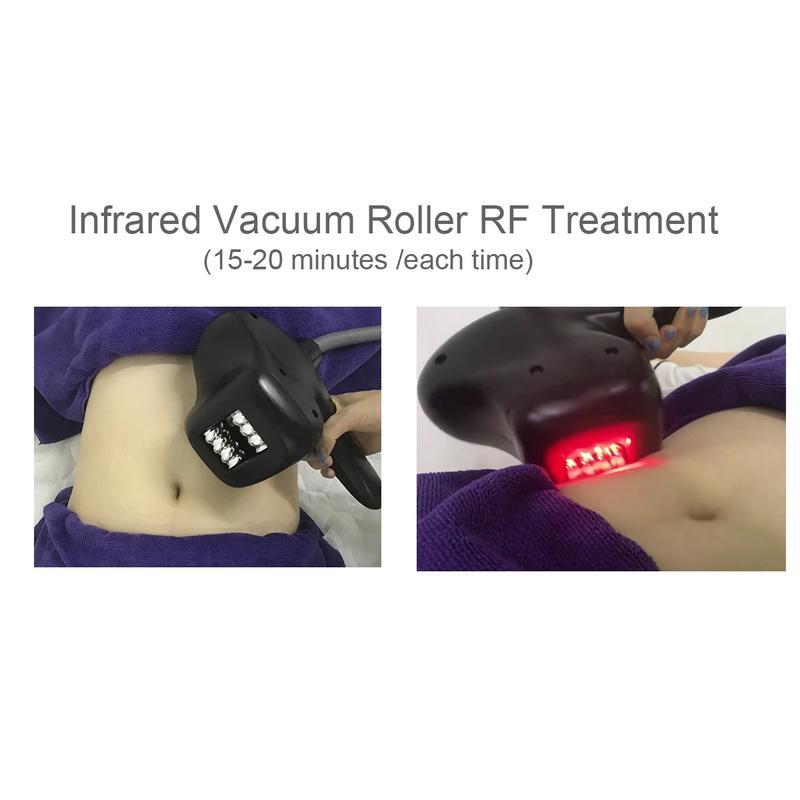Appareil de mise en forme du corps par massage à rouleau à vide pour la réduction des graisses, nouvelle arrivée 2023