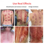 Stimulateur musculaire EMS pour l''amincissement du corps, machine de thérapie par électrostimulation à ondes russes et cupping mammaire sous vide