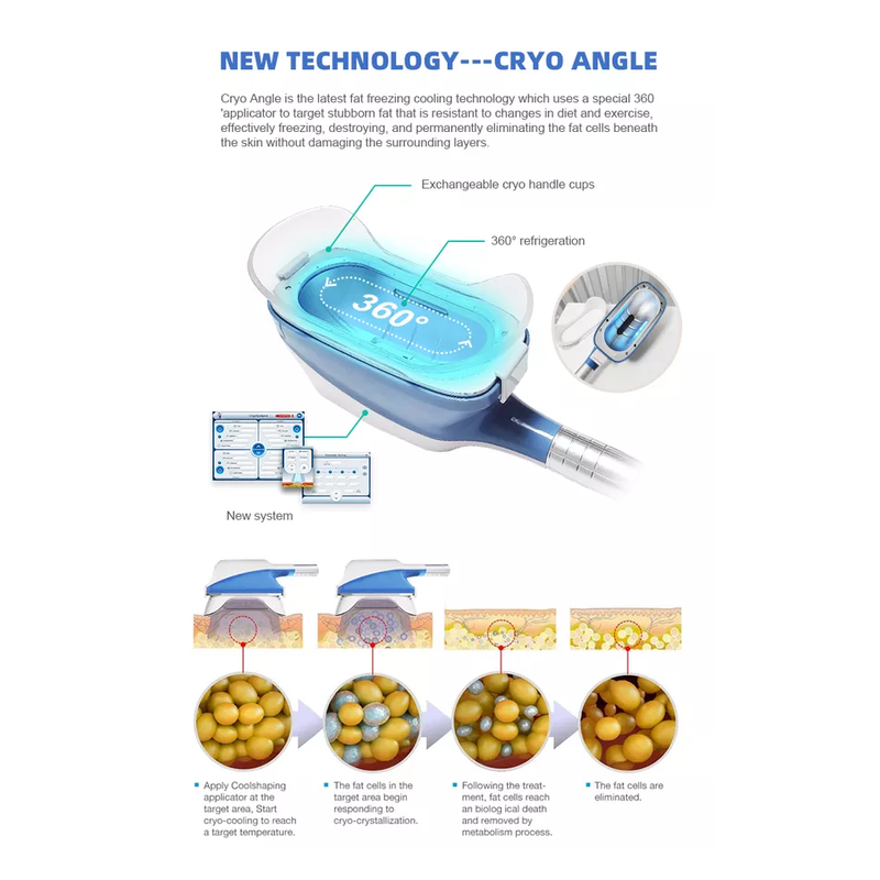 Machine de cryolipolyse 360 Cryo 2022 au meilleur prix pour perte de poids par cryolipolyse