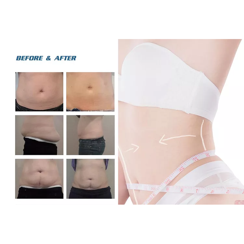Vente en usine 2022 Machine d''amincissement par cryolipolyse 360 / Machine de refroidissement des graisses Cool Tech Réduction de la cellulite