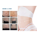Vente en usine 2022 Machine d''amincissement par cryolipolyse 360 / Machine de refroidissement des graisses Cool Tech Réduction de la cellulite