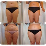 Machine professionnelle de mise en forme du corps par stimulation musculaire électrique Trusculpt ID