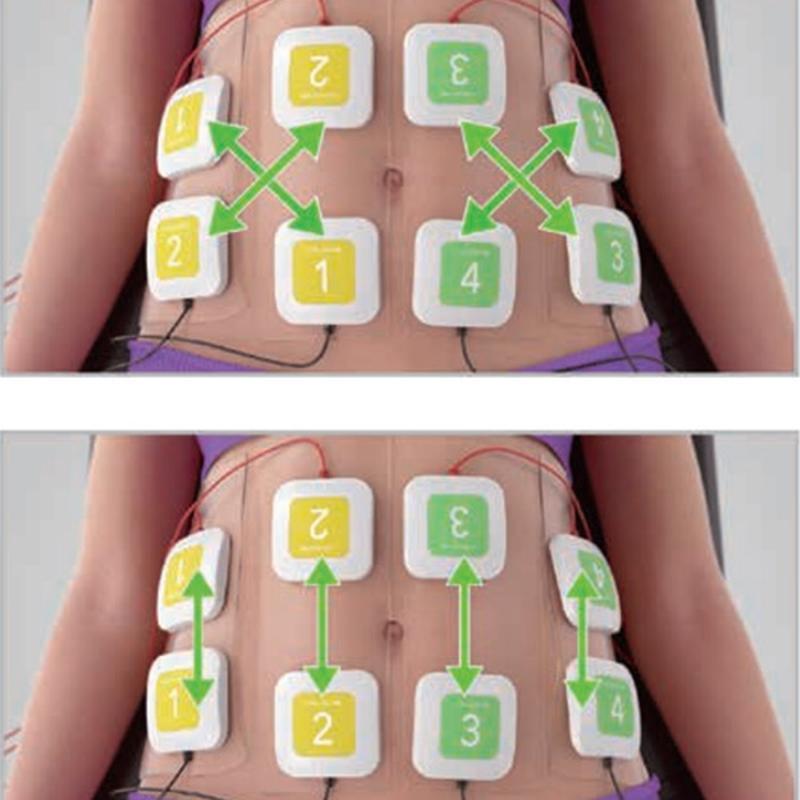Machine professionnelle de mise en forme du corps par stimulation musculaire électrique Trusculpt ID