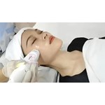 Machine de radiofréquence Mmfu Cyclone Rf Lifting facial indolore Machine Rf pour raffermir la peau et supprimer les rides