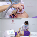 1 000 000 tirs 8D Refroidissement par glace HIFU 5D Smas Lifting Soin de la peau Machine de beauté