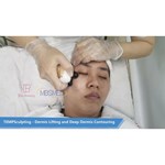 Machine HIFU 12D ICE pour le lifting facial, resserrement de la peau HIFU