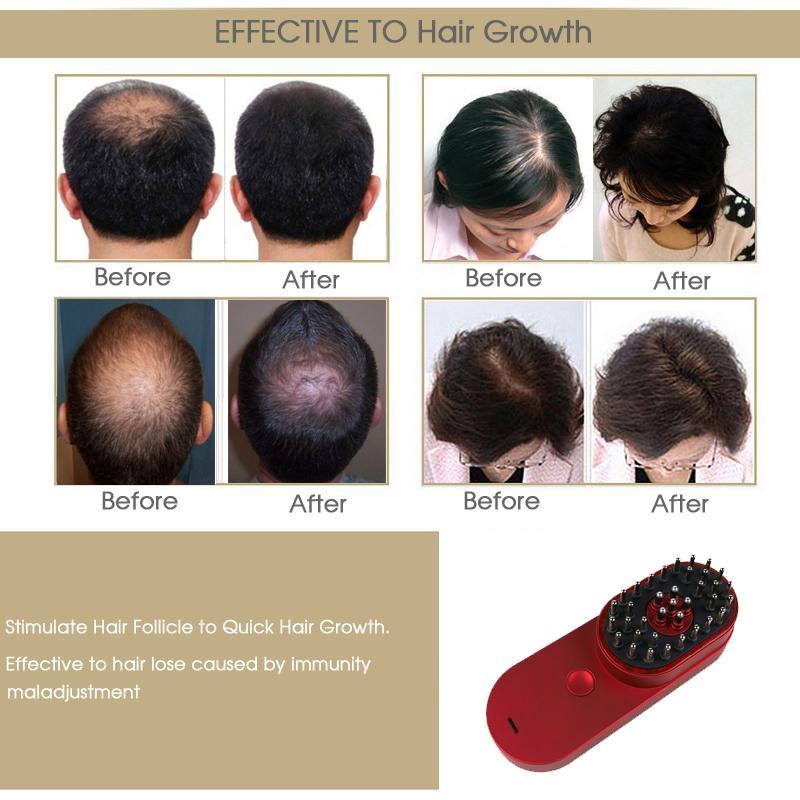 Brosse à cheveux ionique électrique mini portable antistatique pour le soin du cuir chevelu et traitement de perte de cheveux