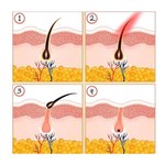 Nouvelle machine d''épilation à lumière pulsée intense de type IPL