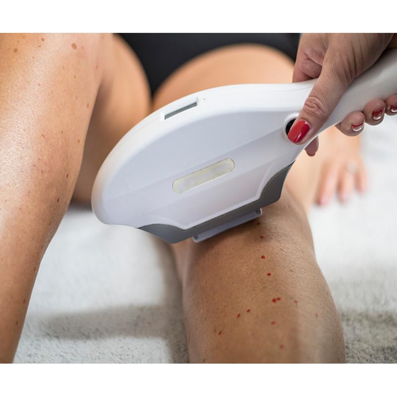 Nouvelle machine d''épilation à lumière pulsée intense de type IPL