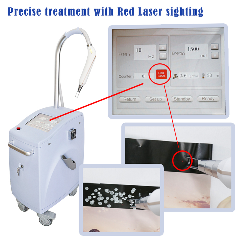 Machine de détatouage au laser Nd Yag Q Switch Pico Laser Pigment