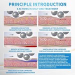 Réduction de la cellulite Contournement du corps Drainage lymphatique Roulis minceur 360° Massage à rouleau interne 6D